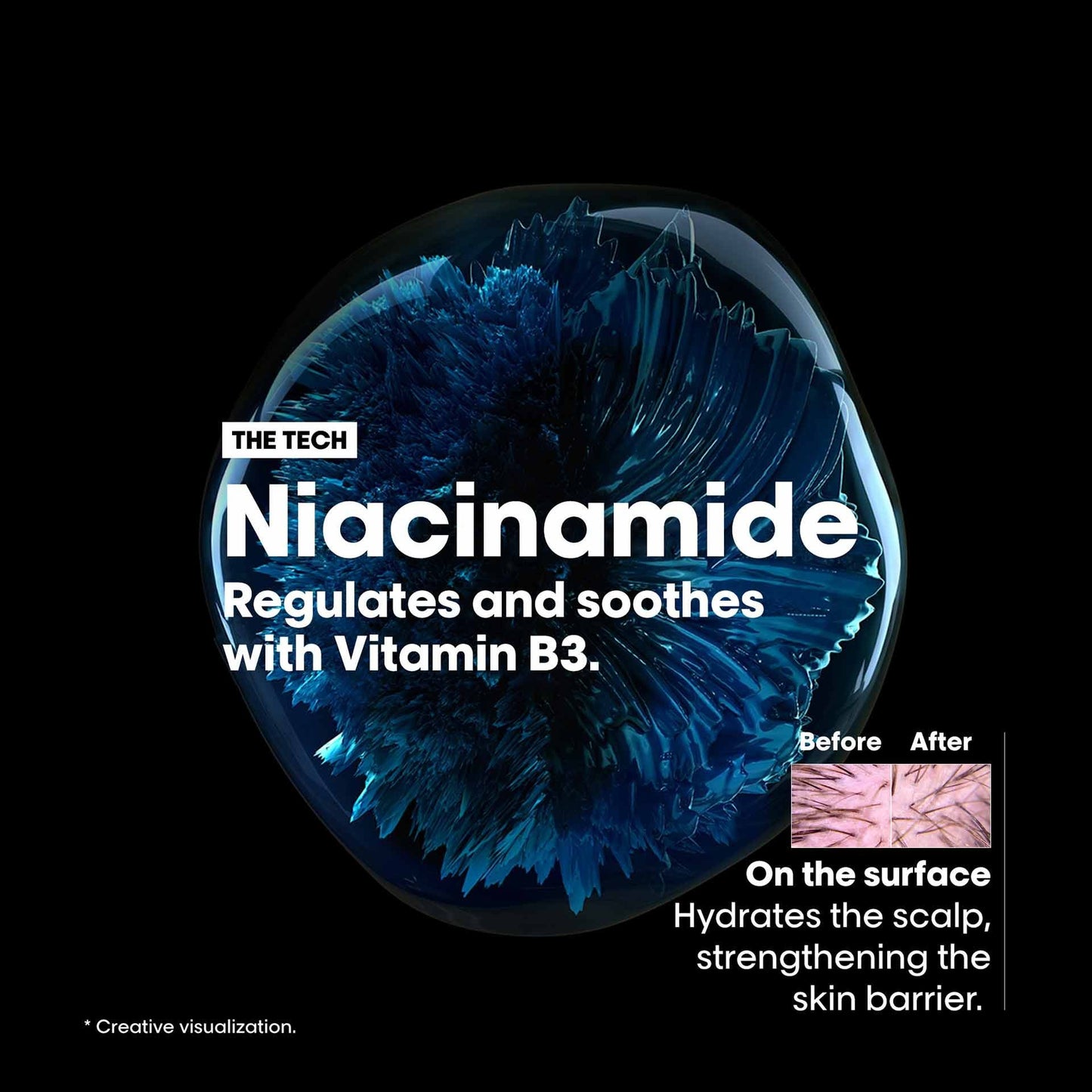 Loreal Professional Scalp Advanced anti-discomfort dermo-regulator shampoo