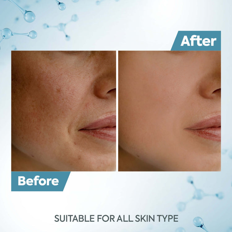 Raaga Professional De-Tan Pack | Tan Removal Cream with Kojic and Milk (500 gm)