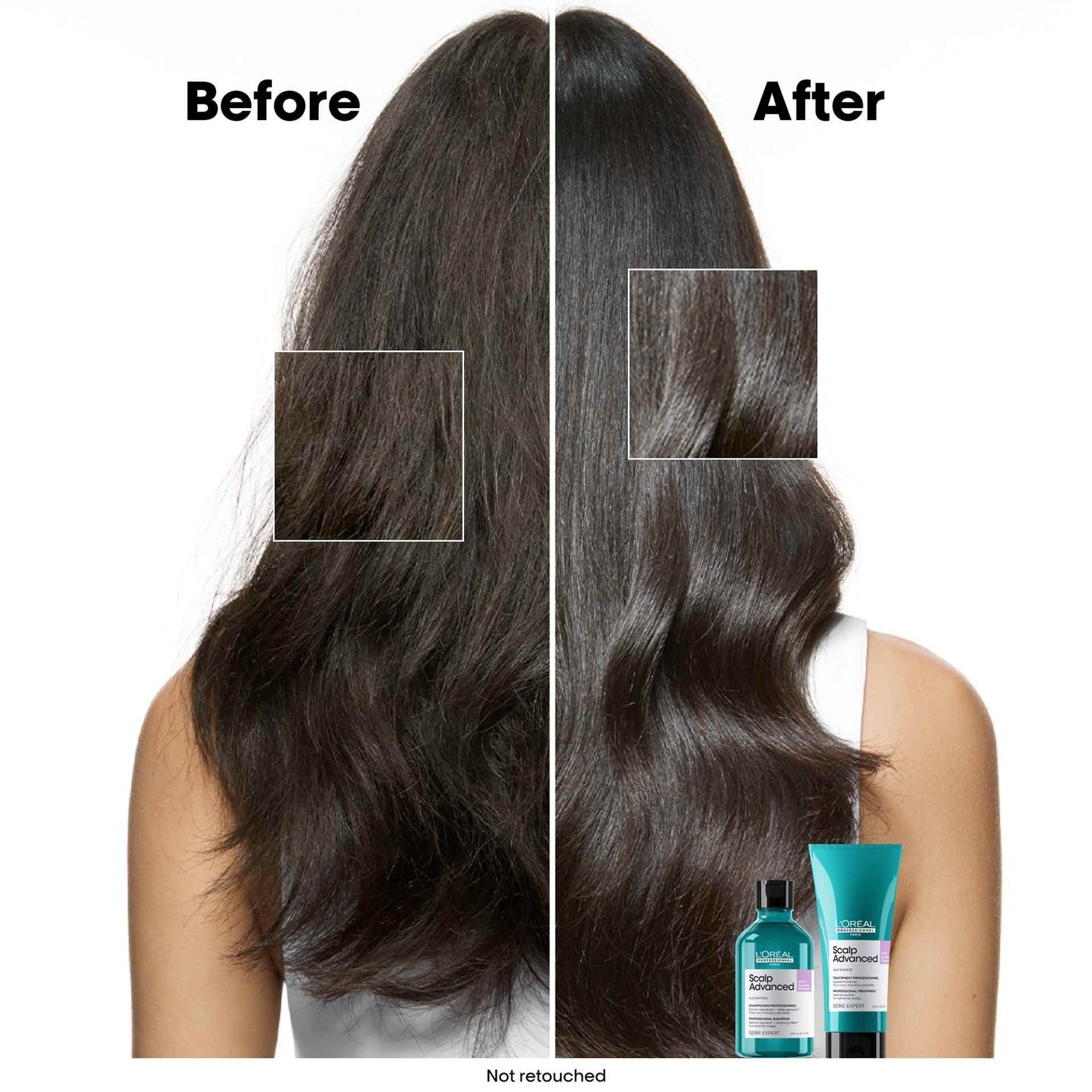 Loreal Professional Scalp Advanced anti-discomfort dermo-regulator shampoo